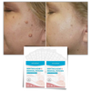 Painless Skin Tag Removal Patch With Breathable Natural Ingredients