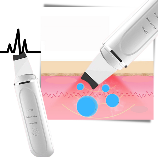 Premium Ultrasonic Facial Cleansing Device for Clear Radiant Skin