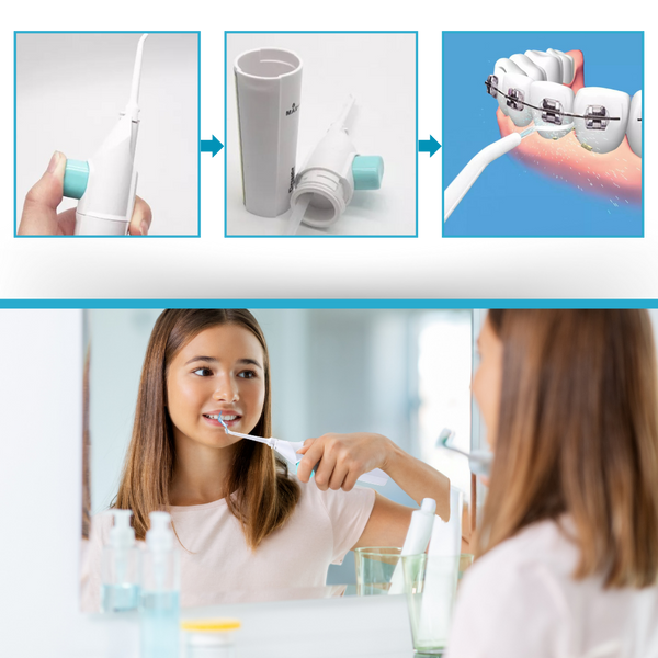 Air Powered Water Flosser Battery Free For Superior Plaque Removal On The Go