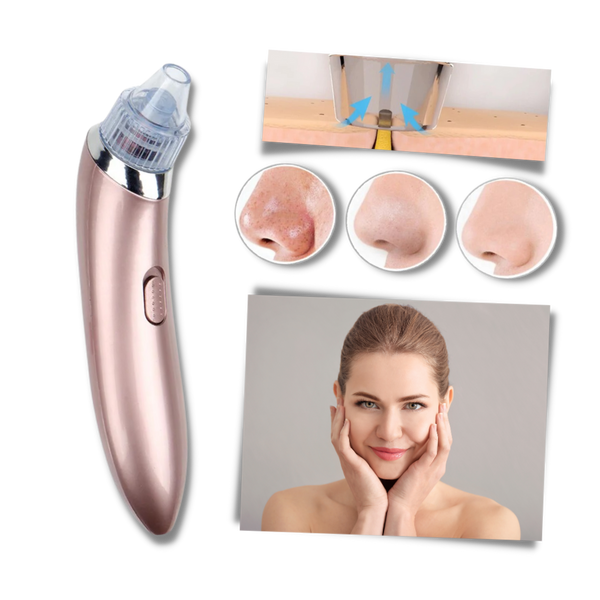 Premium Gentle Facial Blackhead Removal Kit For Sensitive Skin