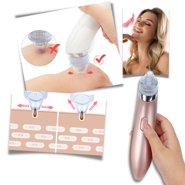 Premium Gentle Facial Blackhead Removal Kit For Sensitive Skin