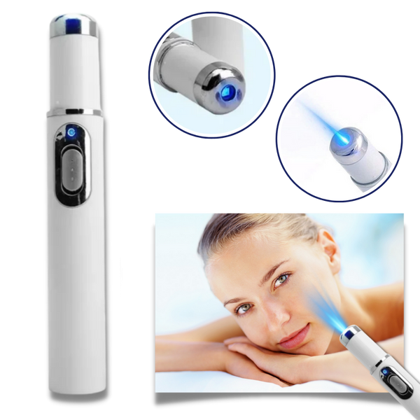 Blue Laser Pen for Dark Spots and Hyperpigmentation Reduction