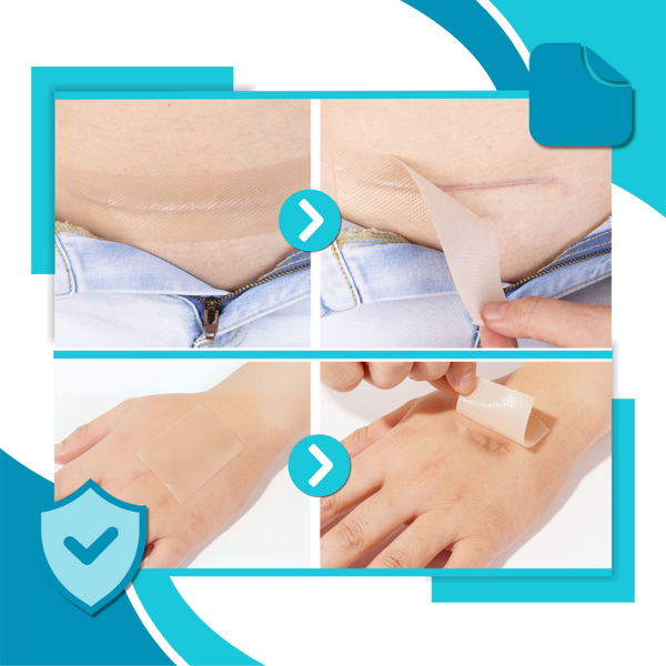 Discreet Silicone Scar Patch For Hydration And Gentle Comfort