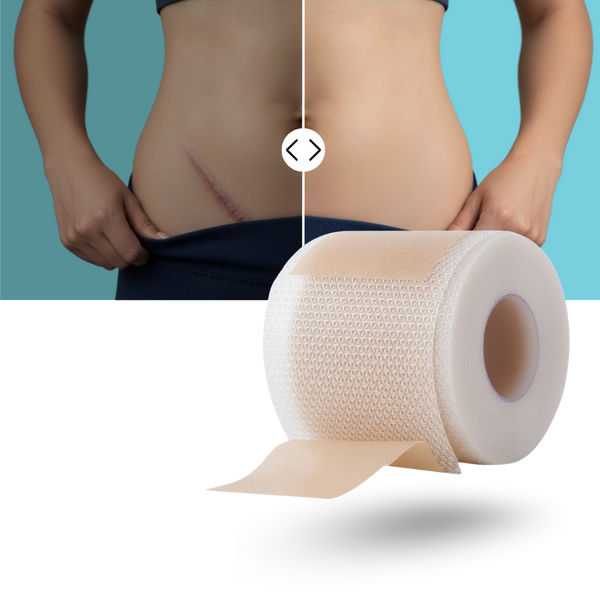 Discreet Silicone Scar Patch For Hydration And Gentle Comfort