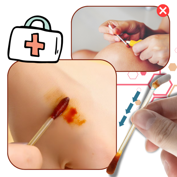 Dual-Action Iodine Skin Cleaning Swabs For Gentle Hygiene