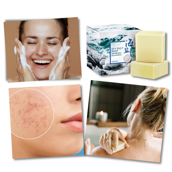 Goat Milk Sea Salt Acne Relief Soap For Oily And Hydrated Skin