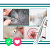 Dual Head Tick Extraction Tool For Humans And Pets With Safe Precision