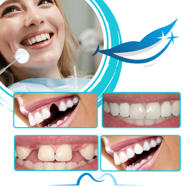Customizable Reusable Fake Teeth Kit For Natural Looking Smile