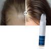 Scalp Nourishing Roll On Serum For Stronger Roots And Fuller Hair