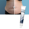 Silicone Scar Hydration Cream For Quick Absorption And Non Greasy Comfort