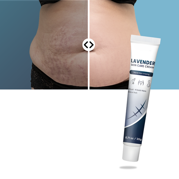 Silicone Scar Hydration Cream For Quick Absorption And Non Greasy Comfort