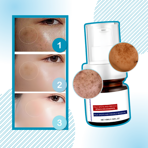 Radiant Kojic Serum For Even Skin Tone And Silky Texture Fast Absorption