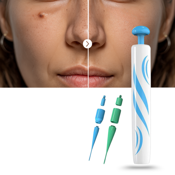 Gentle Skin Tag Eliminator Device Pain Free At Home Treatment