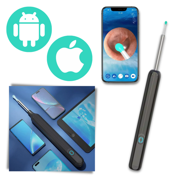 HD Ear Wax Removal Camera With Smart Temperature For Safe Gentle Cleaning