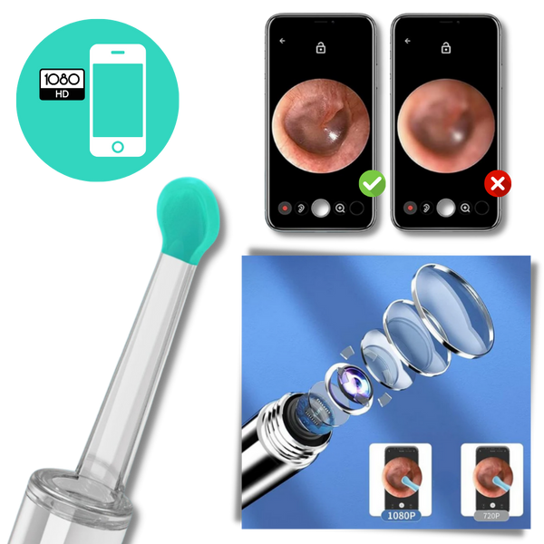 HD Ear Wax Removal Camera With Smart Temperature For Safe Gentle Cleaning