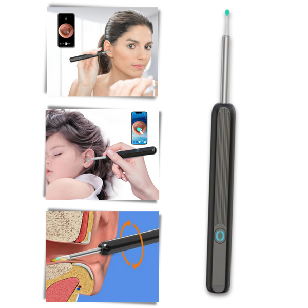 HD Ear Wax Removal Camera With Smart Temperature For Safe Gentle Cleaning