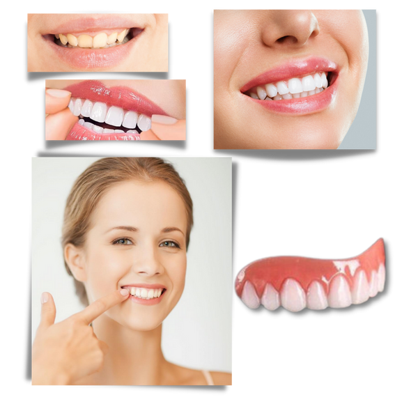 Custom Fit Snap On Veneers For Instant Natural Smile
