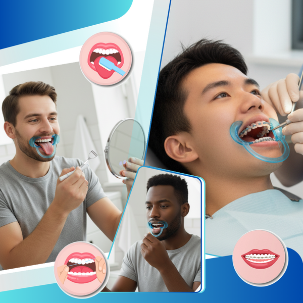 Clear C Shape Mouth Opener for Precise Hygienic Dental Exams