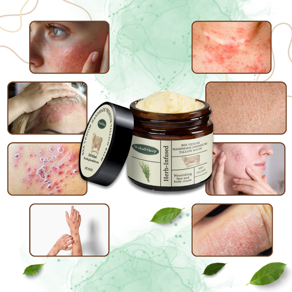 Bee Venom Hydrating Cream For Deep Moisture And Soft Skin