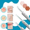 Multifunctional Precision Pointed Tweezers Set For Flawless Skin