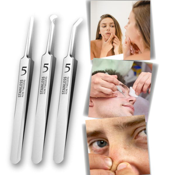 Multifunctional Precision Pointed Tweezers Set For Flawless Skin