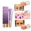 High Frequency Eye Rejuvenation Device For Firming And Brightening
