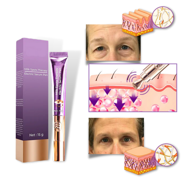 High Frequency Eye Rejuvenation Device For Firming And Brightening